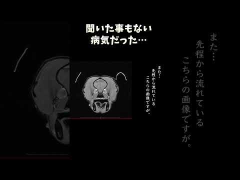 聞いた事もない病気だった サムネイル